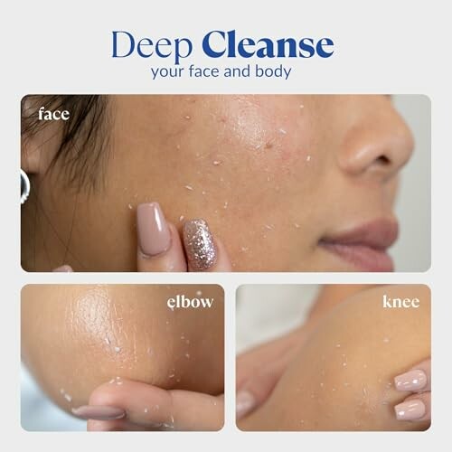 Exfoliating skin on face, elbow, and knee.